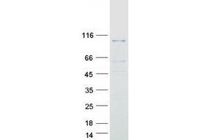 Validation with Western Blot (DGKG Protein (Transcript Variant 2) (Myc-DYKDDDDK Tag))