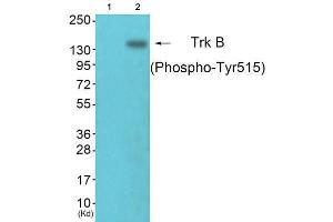 Western Blotting (WB) image for anti-Neurotrophic Tyrosine Kinase, Receptor, Type 2 (NTRK2) (pTyr515) antibody (ABIN1847227) (TRKB antibody  (pTyr515))