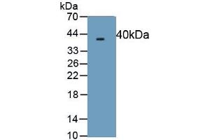 Detection of Recombinant PINP, Human using Monoclonal Antibody to Procollagen I N-Terminal Propeptide (PINP) (PINP antibody)