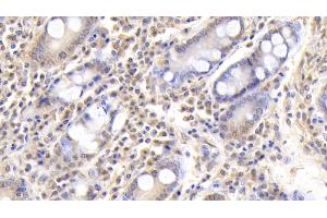 Immunohistochemistry (IHC) image for anti-Fibrinogen beta Chain (FGB) (AA 45-491) antibody (ABIN7428047)