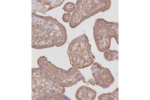 Immunohistochemistry (Paraffin-embedded Sections) (IHC (p)) image for anti-Protein Kinase, CGMP-Dependent, Type I (PRKG1) (AA 629-660), (C-Term) antibody (ABIN392536)
