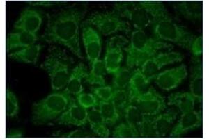 Immunofluorescence (IF) image for anti-Heat Shock Protein 90kDa alpha (Cytosolic), Class A Member 1 (HSP90AA1) antibody (ABIN453942) (HSP90AA1 antibody)