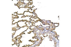 Immunohistochemistry of paraffin-embedded human tonsil using ICAM-1/CD54 Rabbit pAb (ABIN6129231, ABIN6142118, ABIN6142120 and ABIN6221235) at dilution of 1:100 (40x lens). (ICAM1 antibody  (AA 250-480))