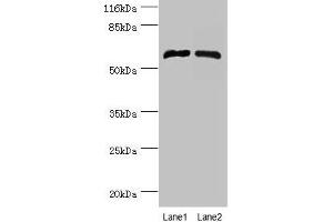 Western blot All lanes: CYP4F11 antibody at 2 μg/mL Lane 1: Mouse liver tissue Lane 2: Mouse kidney tissue Secondary Goat polyclonal to rabbit IgG at 1/10000 dilution Predicted band size: 61 kDa Observed band size: 61 kDa (CYP4F11 antibody  (AA 38-524))