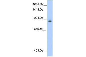 WB Suggested Anti-ACO1 Antibody Titration:  0. (Aconitase 1 antibody  (N-Term))