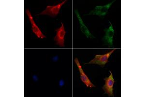 ABIN7094120 and ABIN7098164 staining Hela cells by IF/ICC.