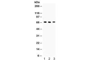 Western blot testing of 1) rat brain, 2) mouse brain and 3) human 22RV1 lysate with Alpha Internexin antibody at 0.