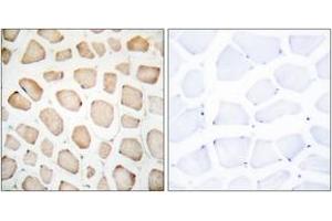 Immunohistochemistry analysis of paraffin-embedded human skeletal muscle tissue, using CHOP (Ab-30) Antibody. (DDIT3 antibody  (AA 15-64))