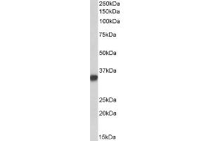 ABIN2613403 (0. (CD74 antibody  (Internal Region))