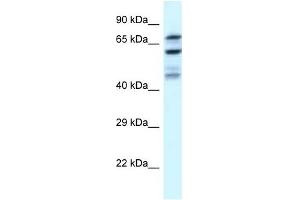 Western Blot showing EIF2B5 antibody used at a concentration of 1 ug/ml against U937 Cell Lysate (EIF2B5 antibody  (N-Term))