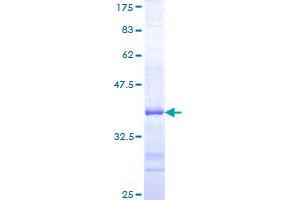 Image no. 1 for Chondroitin Sulfate Proteoglycan 5 (Neuroglycan C) (CSPG5) (AA 445-539) protein (GST tag) (ABIN1350559)