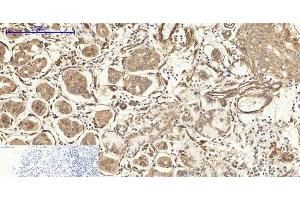 Immunohistochemistry of paraffin-embedded Human stomach tissue using CAV1 Polyclonal Antibody at dilution of 1:200. (Caveolin-1 antibody)