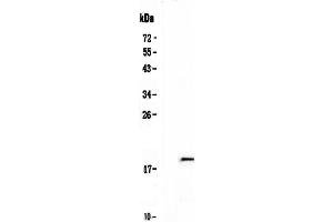 Western blot analysis of IL32 using anti-IL32 antibody .