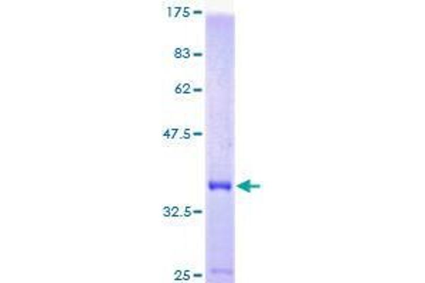 DYNLRB1 Protein (AA 22-96) (GST tag)