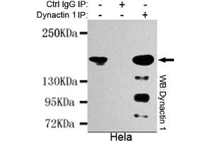 Immunoprecipitation analysis of Hela cell lysates using Dynactin 1 mouse mAb. (Dynactin 1 antibody  (N-Term))