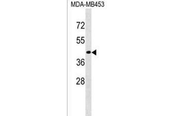 CD200R1L antibody  (N-Term)