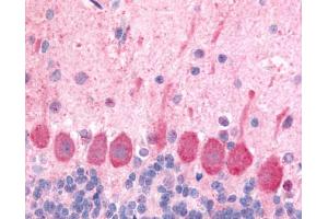Anti-HCRTR1 / Orexin Receptor 1 antibody IHC of rat brain, Purkinje neurons. (HCRTR1 antibody  (Extracellular Domain))
