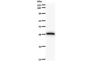 Western Blotting (WB) image for anti-F-Box Protein, Helicase, 18 (FBXO18) antibody (ABIN931163) (FBXO18 antibody)