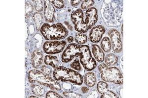 Immunohistochemical staining of human kidney with ZNF519 polyclonal antibody  shows strong cytoplasmic positivity in cells in tubules.