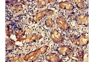 Immunohistochemistry of paraffin-embedded human small intestine tissue using ABIN7174662 at dilution of 1:100 (UAP1 antibody  (AA 1-522))