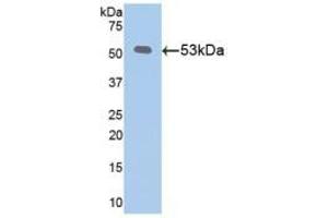 Detection of KL in Recombinant Klotho, Mouse using Polyclonal Antibody to Klotho (KL) (Klotho antibody  (AA 516-955))