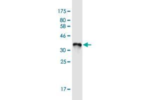 Western Blot detection against Immunogen (36. (ART4 antibody  (AA 61-160))