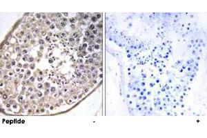 Immunohistochemistry analysis of paraffin-embedded human testis tissue using DNAL4 polyclonal antibody . (DNAL4 antibody  (N-Term))
