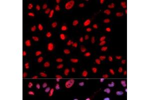 Immunofluorescence analysis of MCF-7 cells using Phospho-Dnmt1(pS714) Polyclonal Antibody (DNMT1 antibody  (pSer714))