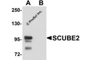 Western Blotting (WB) image for anti-Signal Peptide, CUB Domain, EGF-Like 2 (SCUBE2) (Middle Region) antibody (ABIN1031083) (SCUBE2 antibody  (Middle Region))