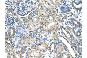 PRPS2 antibody was used for immunohistochemistry at a concentration of 4-8 ug/ml to stain Epithelial cells of renal tubule (arrows) in Human Kidney. (PRPS2 antibody  (Middle Region))