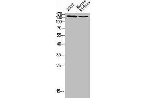 Western blot analysis of 293T lysate, mouse kidney antibody was diluted at 500. (FLT4 antibody  (AA 640-700))