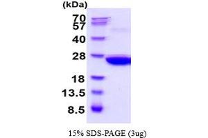 SDS-PAGE (SDS) image for Peroxiredoxin 1 (PRDX1) (AA 1-199) (Active) protein (His tag) (ABIN5854566) (Peroxiredoxin 1 Protein (PRDX1) (AA 1-199) (His tag))