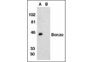 Image no. 2 for anti-Chemokine (C-X-C Motif) Receptor 6 (CXCR6) antibody (ABIN372833)