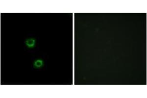 Immunofluorescence analysis of MCF7 cells, using TMEM30C Antibody.