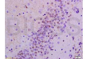 Formalin-fixed and paraffin embedded rat brain labeled with Anti-AMPK alpha-1/PRKAA1 Polyclonal Antibody, Unconjugated (ABIN737886) at 1:200 followed by conjugation to the secondary antibody and DAB staining. (PRKAA1 antibody  (AA 351-450))