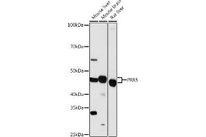 PRR5 antibody  (AA 109-388)