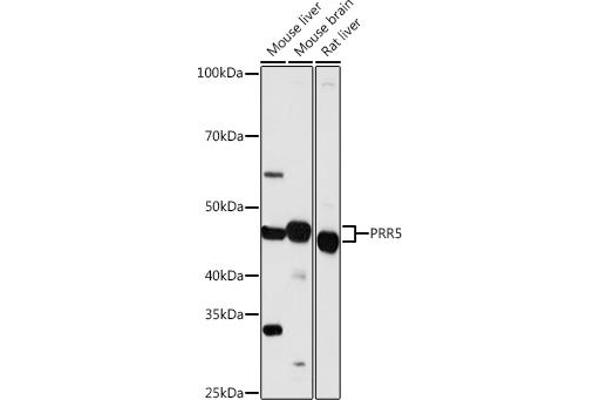 PRR5 Antikörper  (AA 109-388)