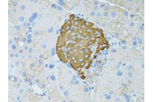 Immunohistochemistry of paraffin-embedded rat pancreas using TEFM antibody (ABIN5974873) at dilution of 1/100 (40x lens). (TEFM antibody)