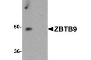 Western blot analysis of ZBTB9 in mouse heart tissue lysate with ZBTB9 antibody at 1 μg/ml in (A) the absence and (B) the presence of blocking peptide.