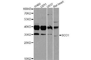 Western blot analysis of extracts of various cell lines, using SCO1 antibody. (SCO1 antibody  (AA 1-160))