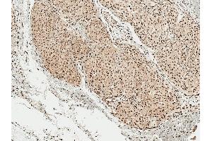 Immunohistochemistry analysis using Rabbit Anti-Alpha Synuclein pSer129 Polyclonal Antibody (ABIN5650951). (SNCA antibody  (pSer129) (PerCP))