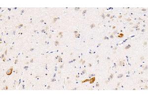 Detection of IL11Ra in Human Cerebrum Tissue using Polyclonal Antibody to Interleukin 11 Receptor Alpha (IL11Ra) (IL11RA antibody  (AA 59-220))