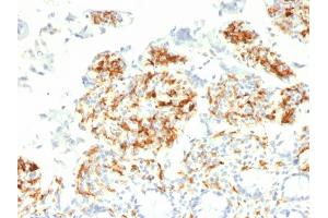 Immunohistochemistry (IHC) image for anti-CD209 (CD209) antibody (ABIN6939610)