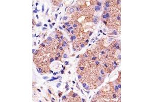 Immunohistochemical staining of formalin-fixed and paraffin-embedded human stomach section reacted with PINK1 monoclonal antibody  at 1:25 dilution. (PINK1 antibody)