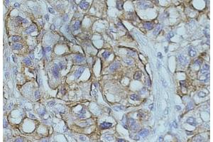 Immunohistochemistry (IHC) image for anti-N-Myc Downstream Regulated 1 (NDRG1) (C-Term) antibody (ABIN184872)