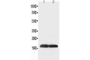Anti-Superoxide Dismutase 1 antibody, Western blotting Lane 1: COLO320 Cell Lysate Lane 2: SMMC Cell Lysate