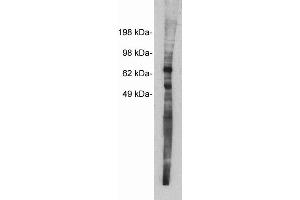 Ship at ambient temperature, freeze upon arrival   Product should be stored at -20ºC. (Netrin 1 antibody)