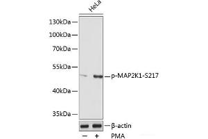Western blot analysis of extracts of various cell lines using Phospho-MAP2K1(S217) Polyclonal Antibody at dilution of 1:1000. (MEK1 antibody  (pSer217))