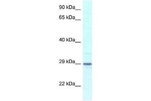 Western Blot showing Kcnip3 antibody used at a concentration of 1. (DREAM antibody  (Middle Region))
