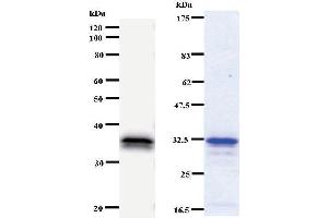 Left: CHES1 staining. (FOXN3 antibody)